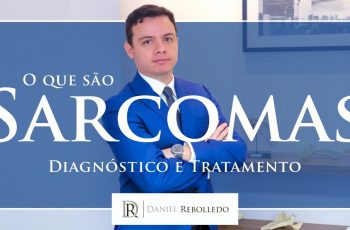 Vídeo novo: O que são sarcomas? Sintomas e Tratamento