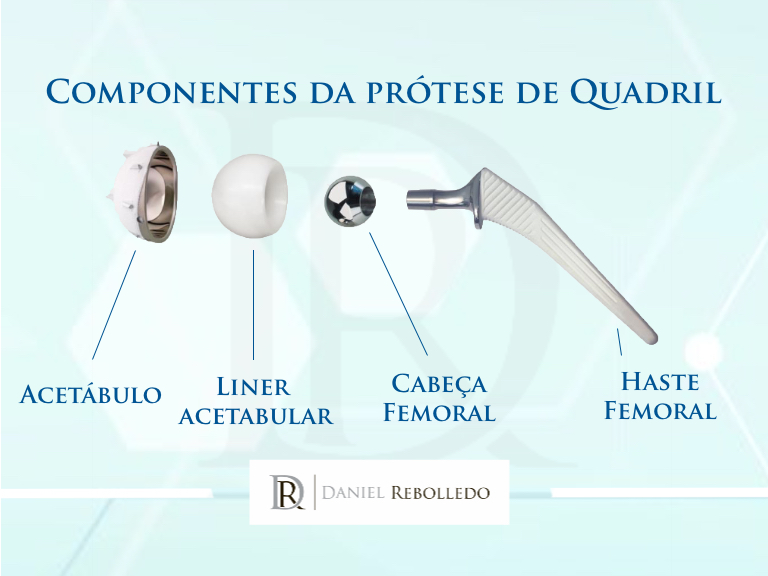 Protese de quadril componentes