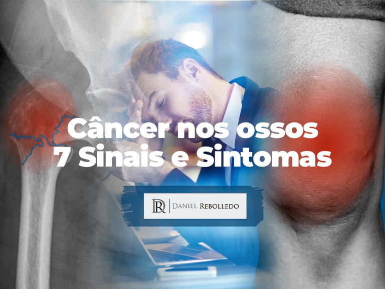 Câncer nos ossos. 7 Sinais e Sintomas