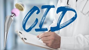 protese de quadril cid