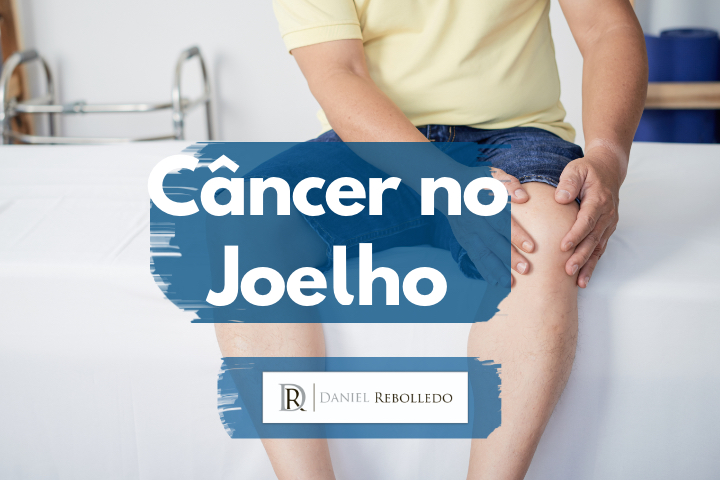 Cancer no joelho