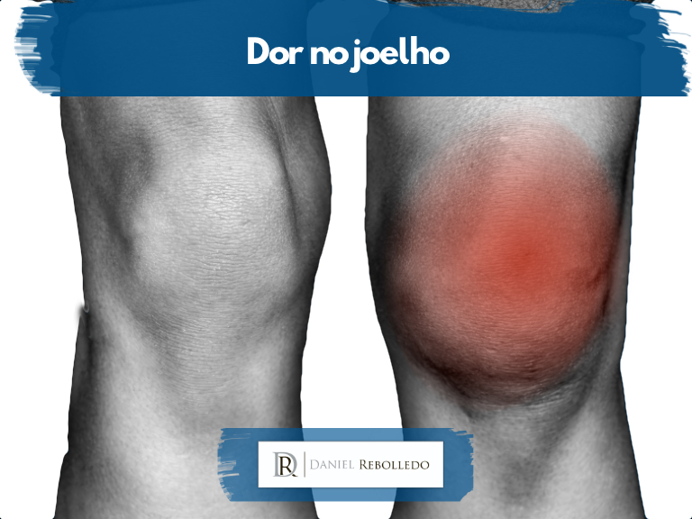 Dor no joelho