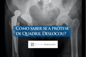 Como saber se a protese de quadril deslocou?