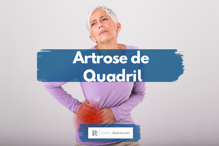 Artrose no quadril é um grave problema para o paciente