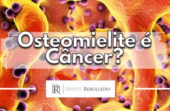 Osteomielite é cancer no osso?