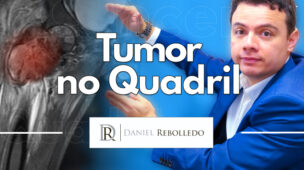 Tumor no Quadril